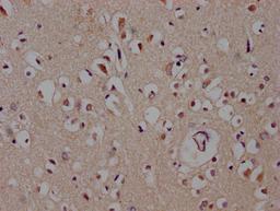 IHC image of CSB-PA873691LA01HU diluted at 1:600 and staining in paraffin-embedded human brain tissue performed on a Leica BondTM system. After dewaxing and hydration, antigen retrieval was mediated by high pressure in a citrate buffer (pH 6.0). Section was blocked with 10% normal goat serum 30min at RT. Then primary antibody (1% BSA) was incubated at 4°C overnight. The primary is detected by a biotinylated secondary antibody and visualized using an HRP conjugated SP system.
