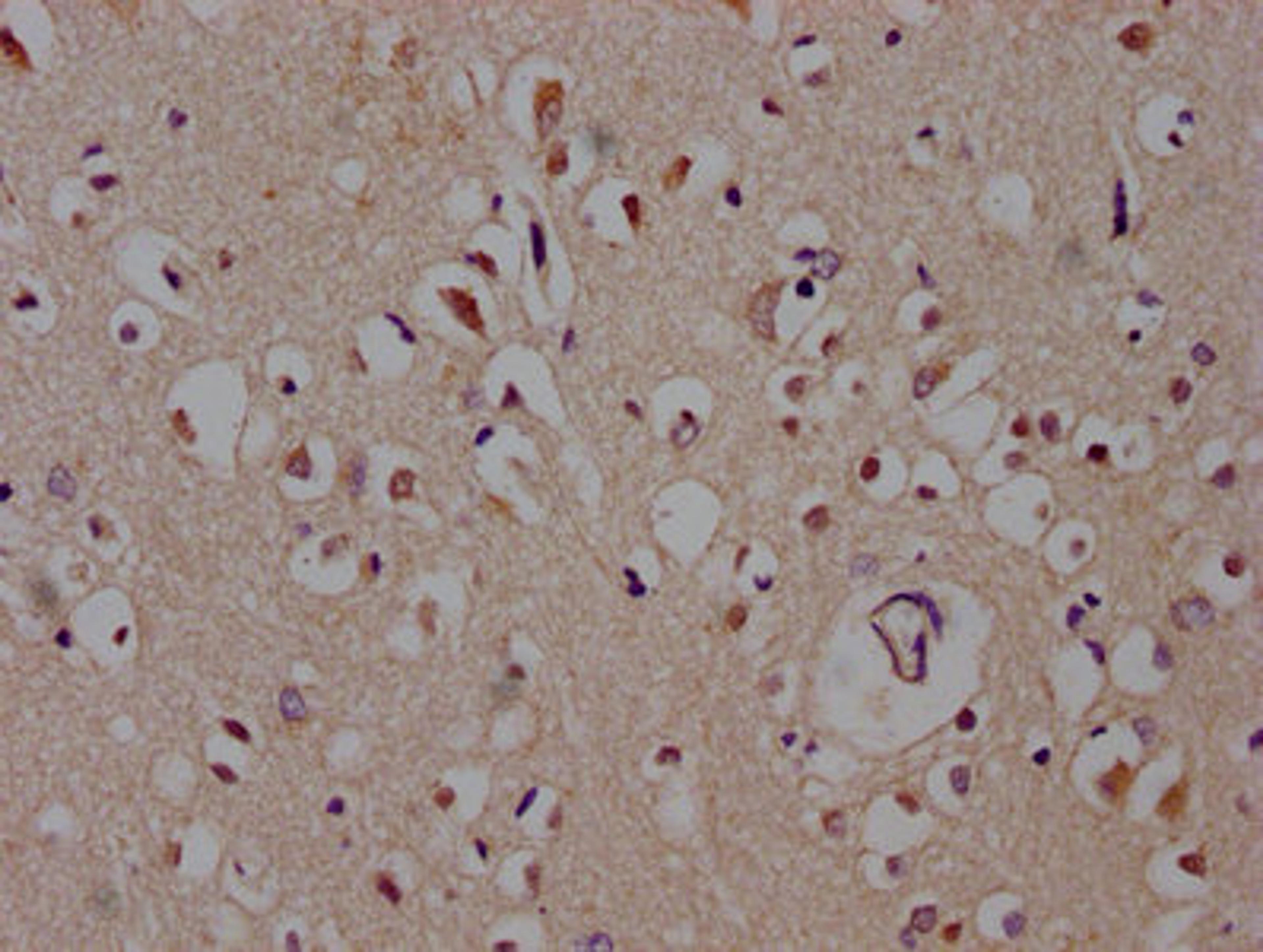 IHC image of CSB-PA873691LA01HU diluted at 1:600 and staining in paraffin-embedded human brain tissue performed on a Leica BondTM system. After dewaxing and hydration, antigen retrieval was mediated by high pressure in a citrate buffer (pH 6.0). Section was blocked with 10% normal goat serum 30min at RT. Then primary antibody (1% BSA) was incubated at 4°C overnight. The primary is detected by a biotinylated secondary antibody and visualized using an HRP conjugated SP system.