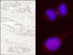 Detection of human KIF14 by immunohistochemistry and immunocytochemistry.