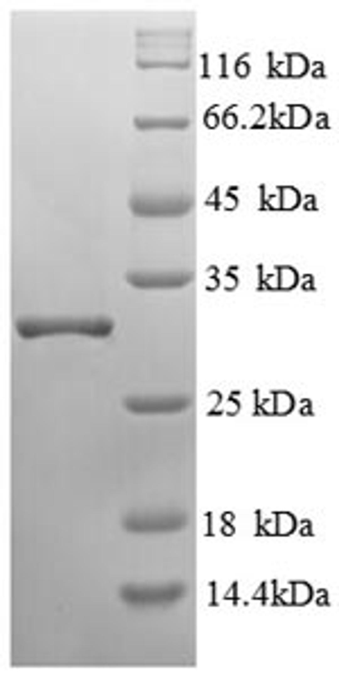 (Tris-Glycine gel) Discontinuous SDS-PAGE (reduced) with 5% enrichment gel and 15% separation gel.