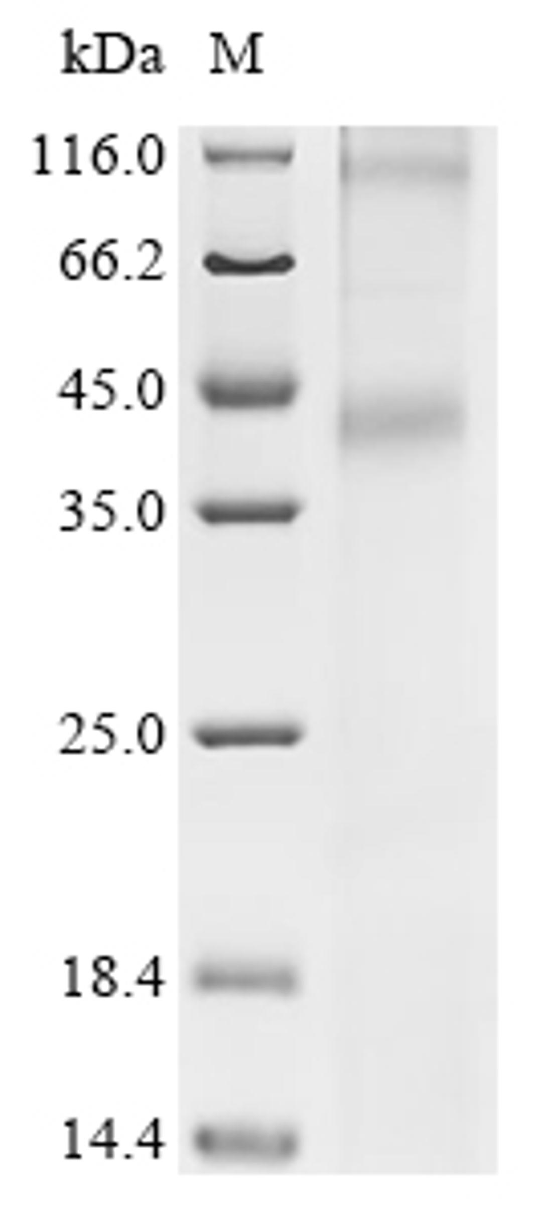 (Tris-Glycine gel) Discontinuous SDS-PAGE (reduced) with 5% enrichment gel and 15% separation gel.