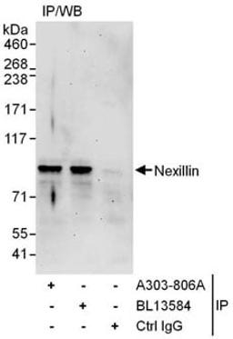 Detection of human Nexillin by western blot of immunoprecipitates.