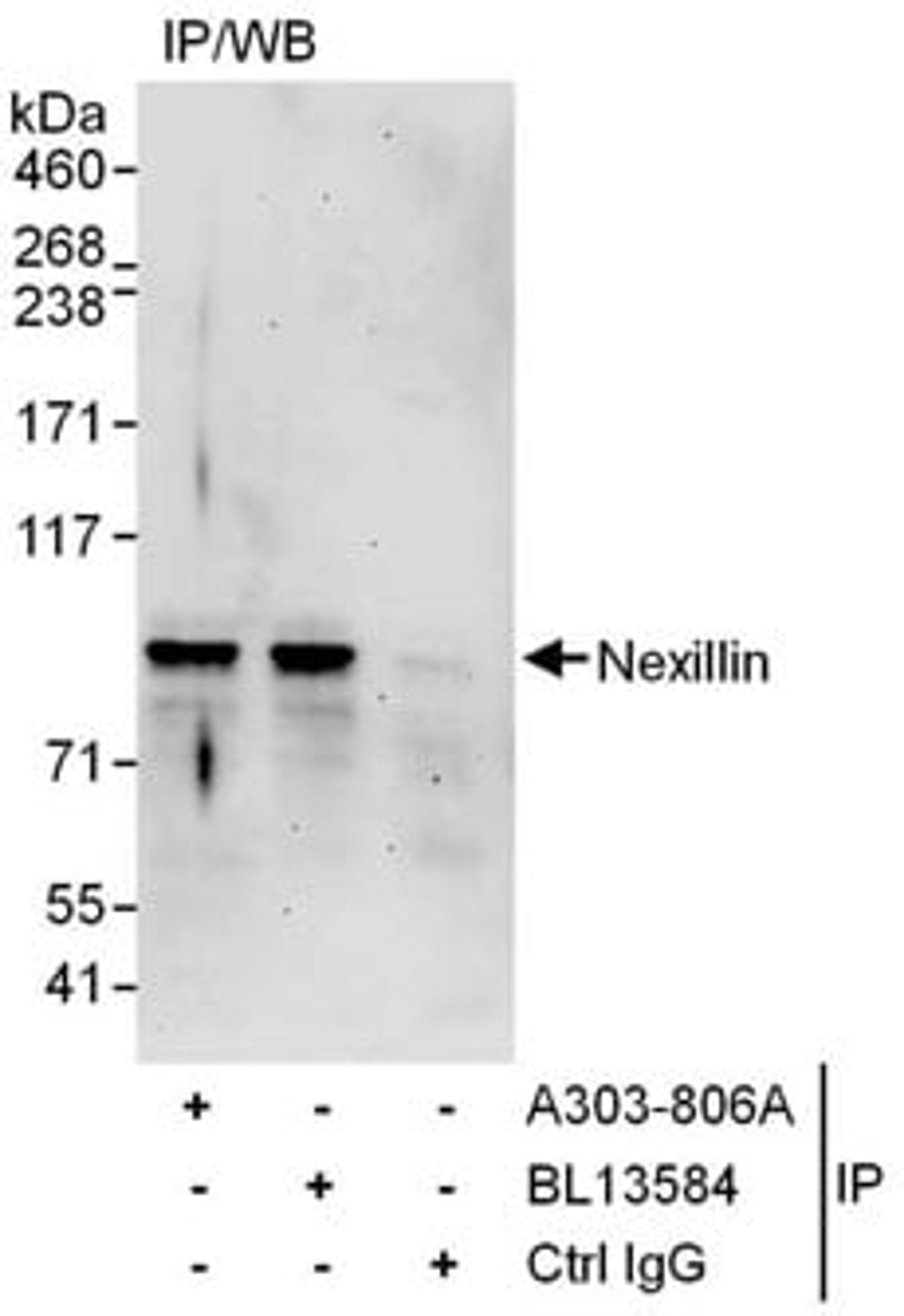 Detection of human Nexillin by western blot of immunoprecipitates.