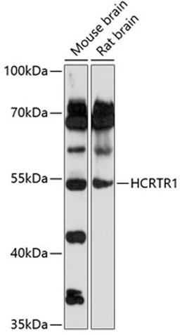 Western blot - HCRTR1 antibody (A14740)