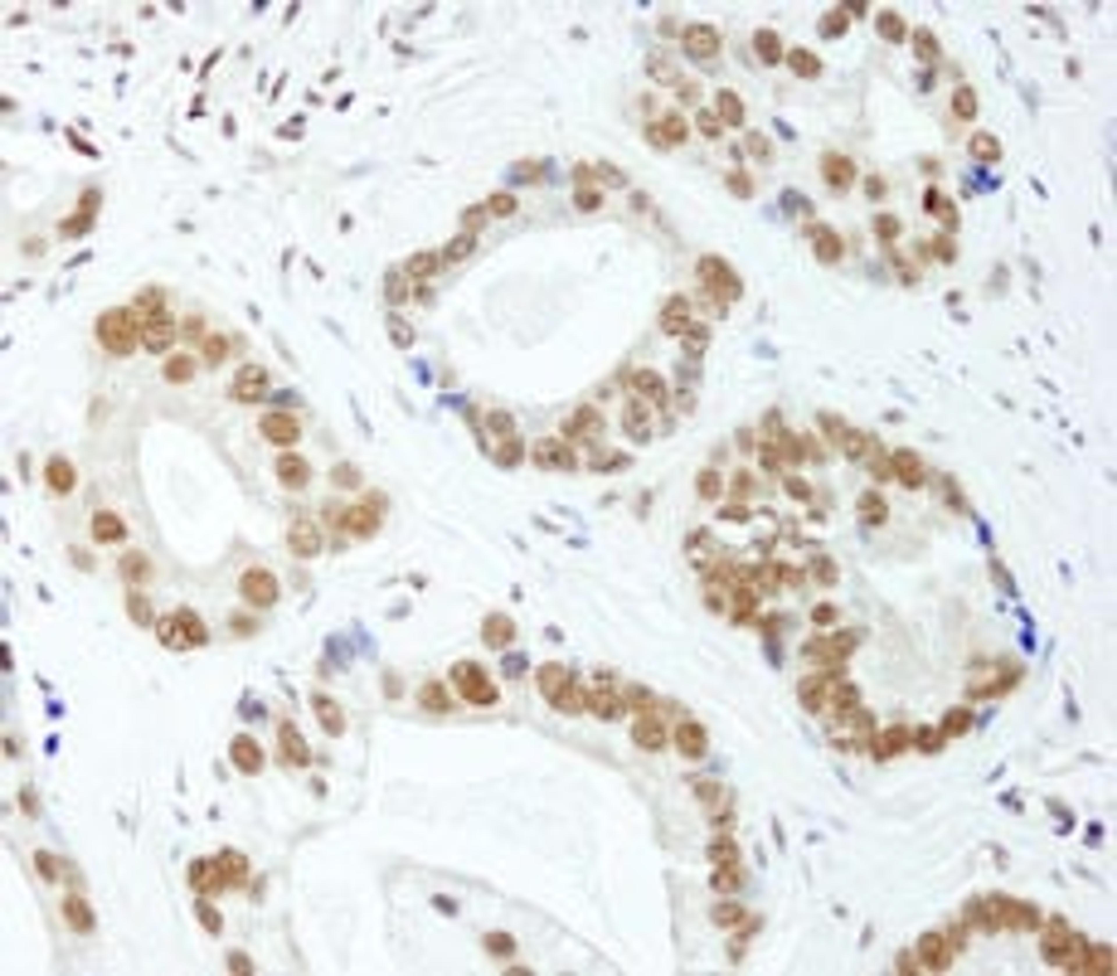 Detection of human E1B-AP5 by immunohistochemistry.