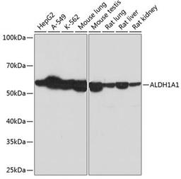 Western blot - ALDH1A1 Rabbit mAb (A0157)