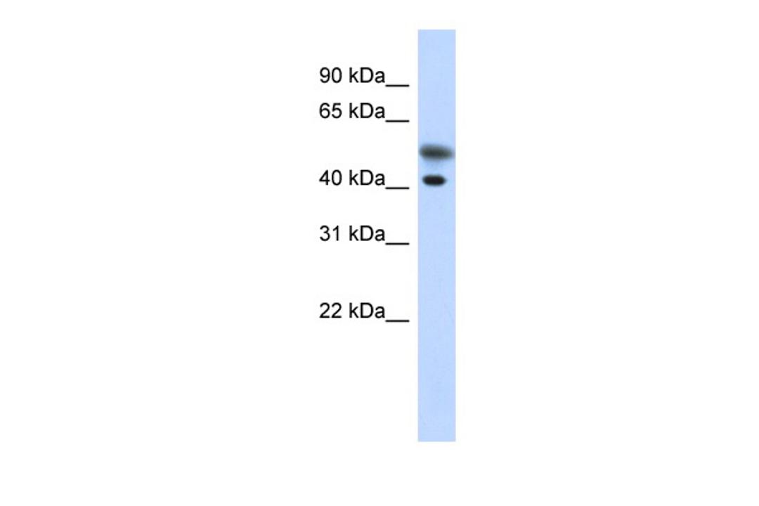 Antibody used in WB on Transfected 293T at 0.2-1 ug/ml.