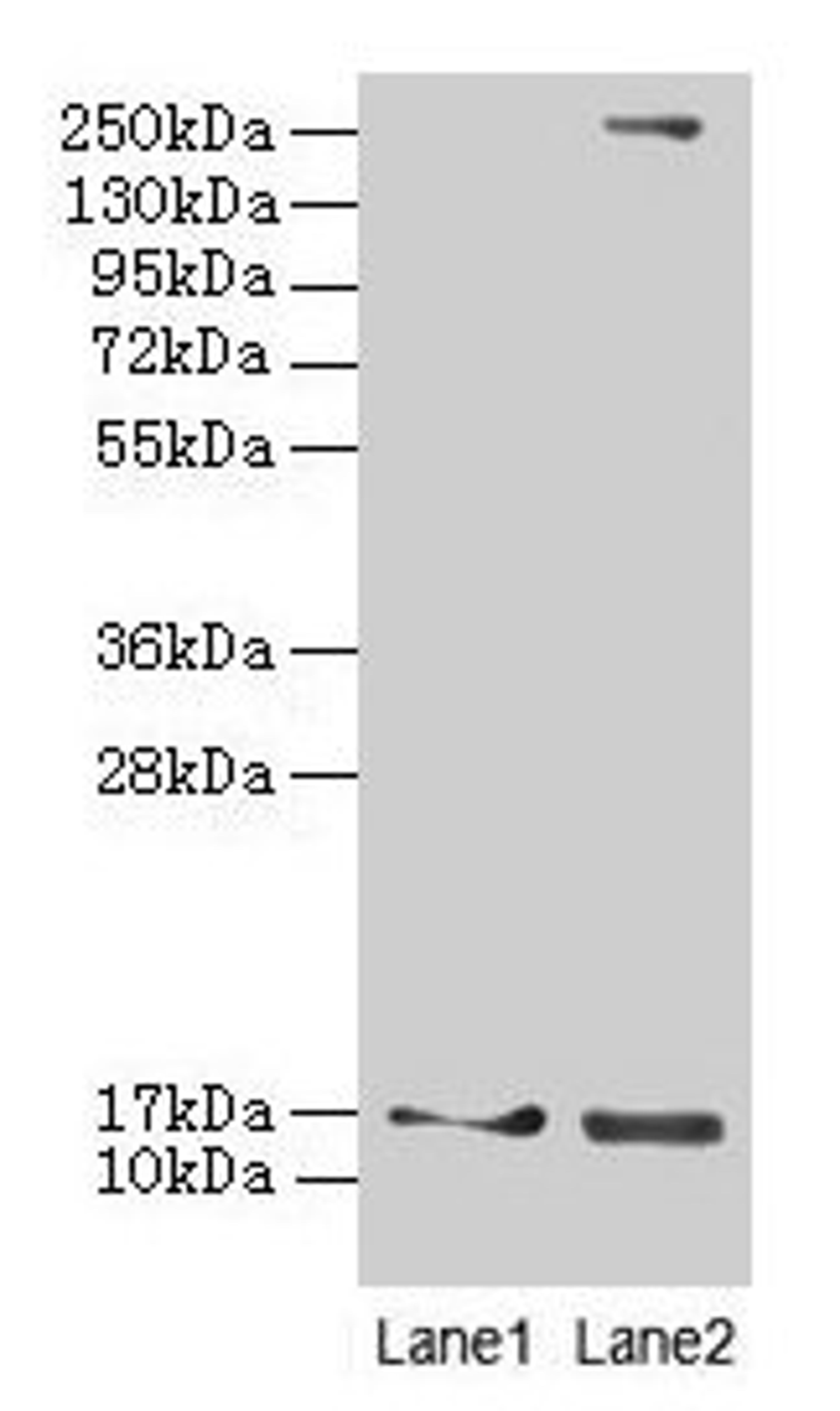 Western blot. All lanes: CRABP1 antibody at 4µg/ml. Lane 1: Mouse eye tissue. Lane 2: THP-1 whole cell lysate. Secondary. Goat polyclonal to rabbit IgG at 1/10000 dilution. Predicted band size: 16 kDa. Observed band size: 16 kDa