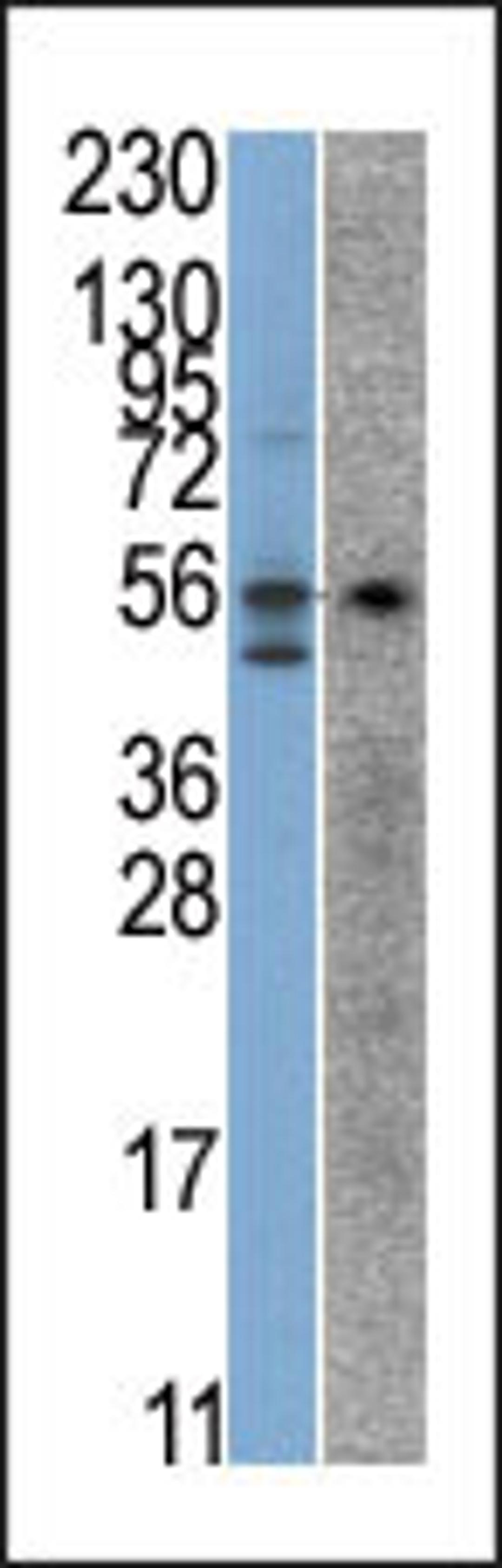 Antibody is used in Western blot to detect STK38 in SK-Br-3 (left) and Jurkat (right) cell line lysates.