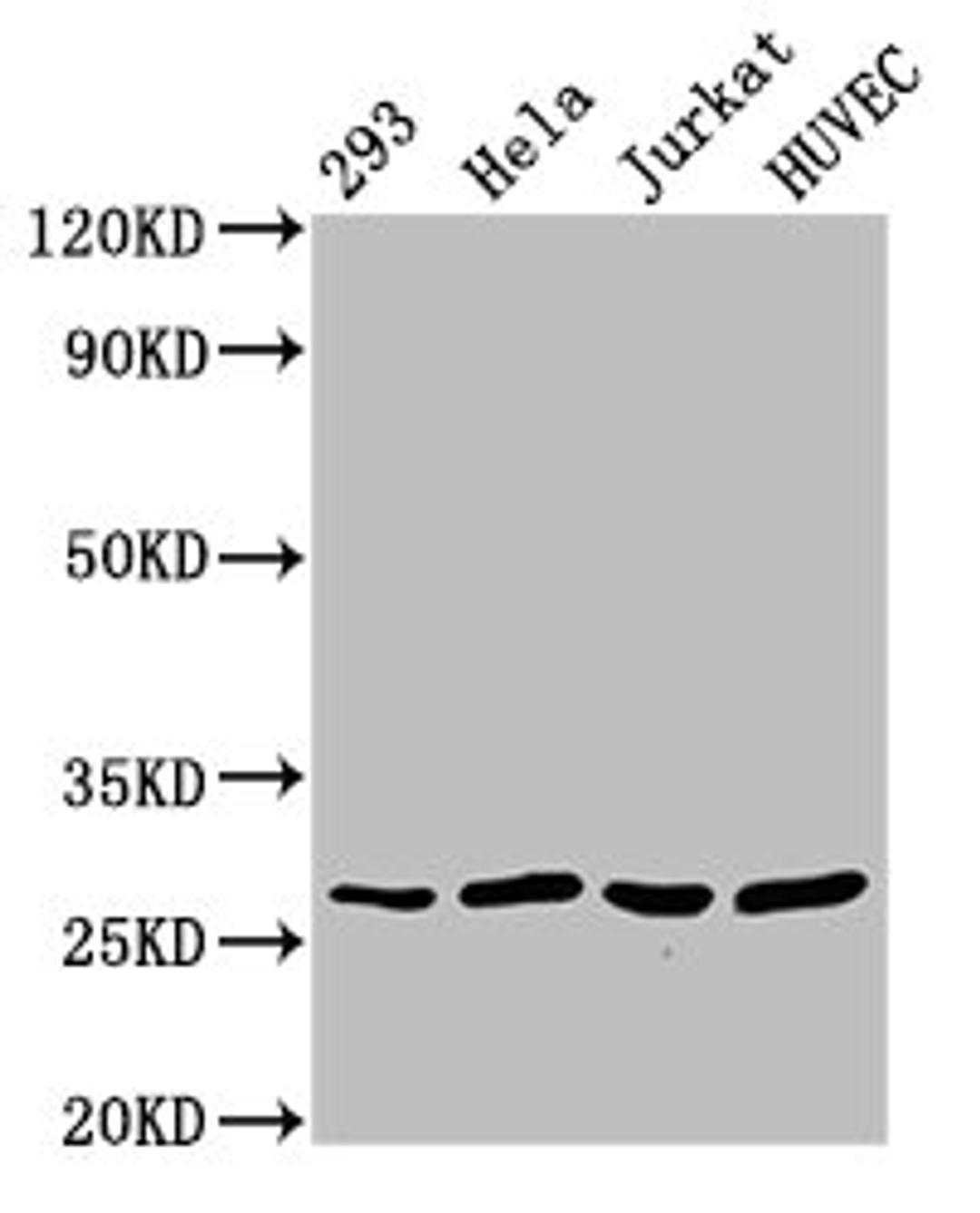 Western Blot. Positive WB detected in: 293 whole cell lysate, Hela whole cell lysate, Jurkat whole cell lysate, HUVEC whole cell lysate. All lanes: CACYBP antibody at 2.7ug/ml. Secondary. Goat polyclonal to rabbit IgG at 1/50000 dilution. Predicted band size: 27, 9, 22 kDa. Observed band size: 27 kDa. 