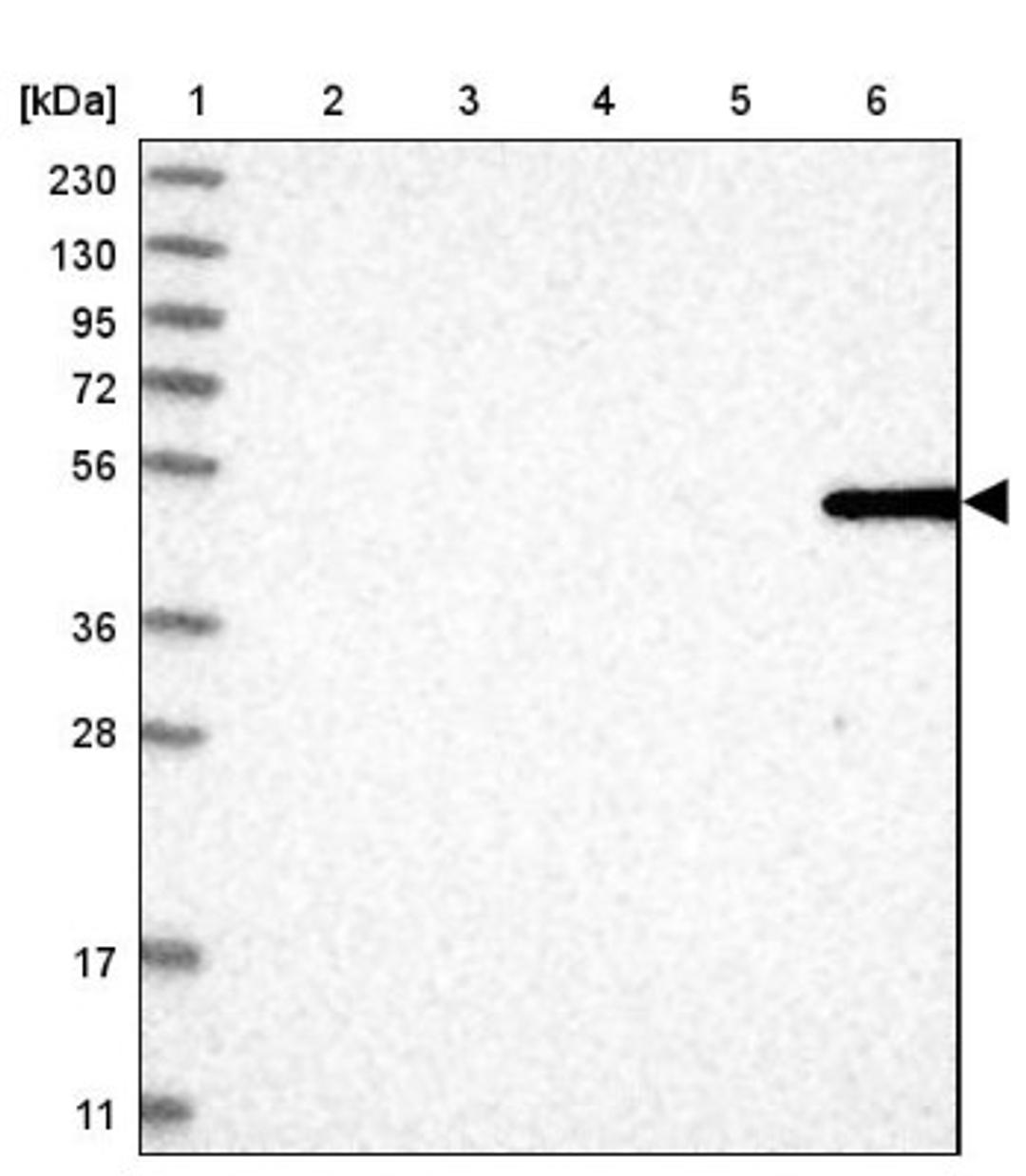 Western Blot: MFSD6L Antibody [NBP1-81967] - Lane 1: Marker [kDa] 230, 130, 95, 72, 56, 36, 28, 17, 11<br/>Lane 2: Human cell line RT-4<br/>Lane 3: Human cell line U-251MG sp<br/>Lane 4: Human plasma (IgG/HSA depleted)<br/>Lane 5: Human liver tissue<br/>Lane 6: Human tonsil tissue