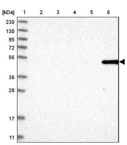 Western Blot: MFSD6L Antibody [NBP1-81967] - Lane 1: Marker [kDa] 230, 130, 95, 72, 56, 36, 28, 17, 11<br/>Lane 2: Human cell line RT-4<br/>Lane 3: Human cell line U-251MG sp<br/>Lane 4: Human plasma (IgG/HSA depleted)<br/>Lane 5: Human liver tissue<br/>Lane 6: Human tonsil tissue