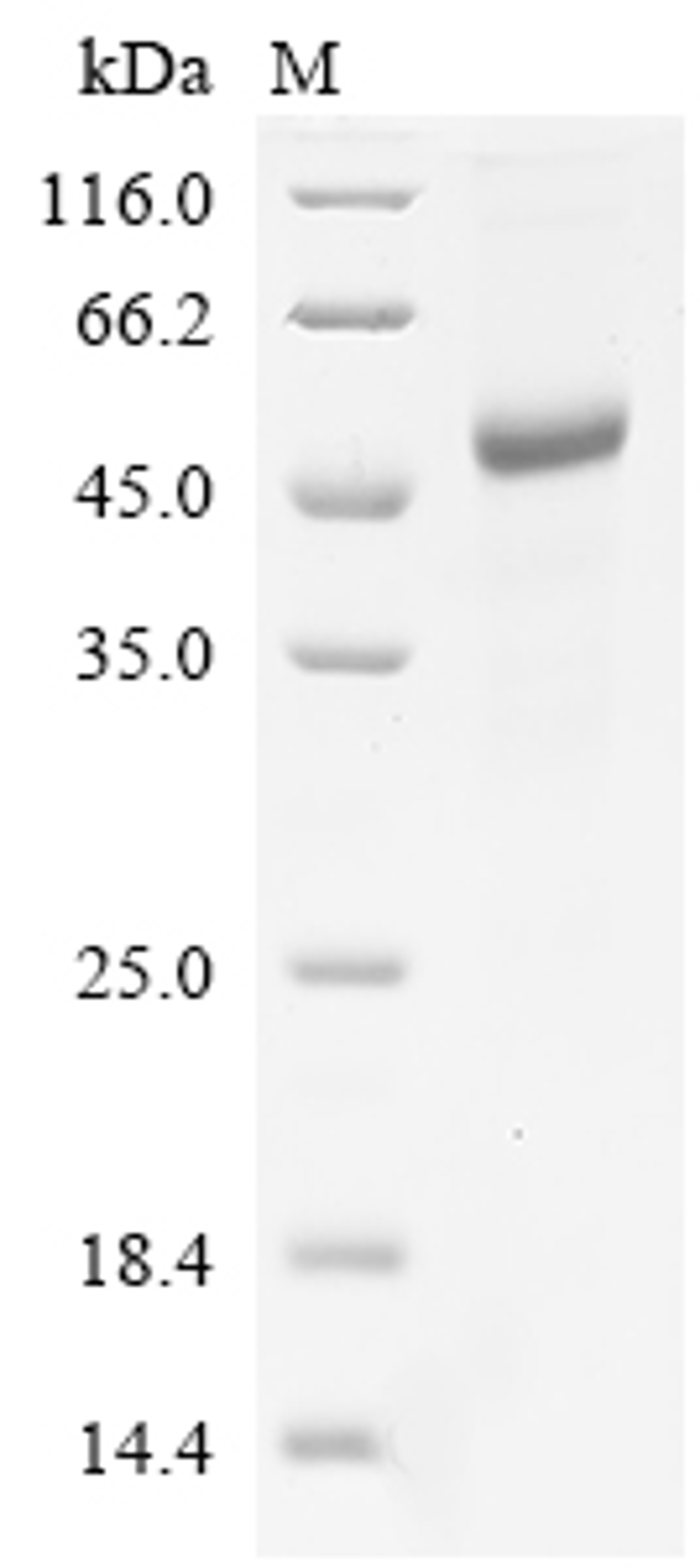 (Tris-Glycine gel) Discontinuous SDS-PAGE (reduced) with 5% enrichment gel and 15% separation gel.