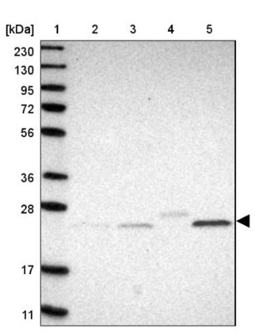 Immunohistochemistry: FAM166A Antibody [NBP1-90930] - Lane 1: Marker [kDa] 230, 130, 95, 72, 56, 36, 28, 17, 11<br/>Lane 2: Human cell line RT-4<br/>Lane 3: Human cell line U-251MG sp<br/>Lane 4: Human plasma (IgG/HSA depleted)<br/>Lane 5: Human liver tissue