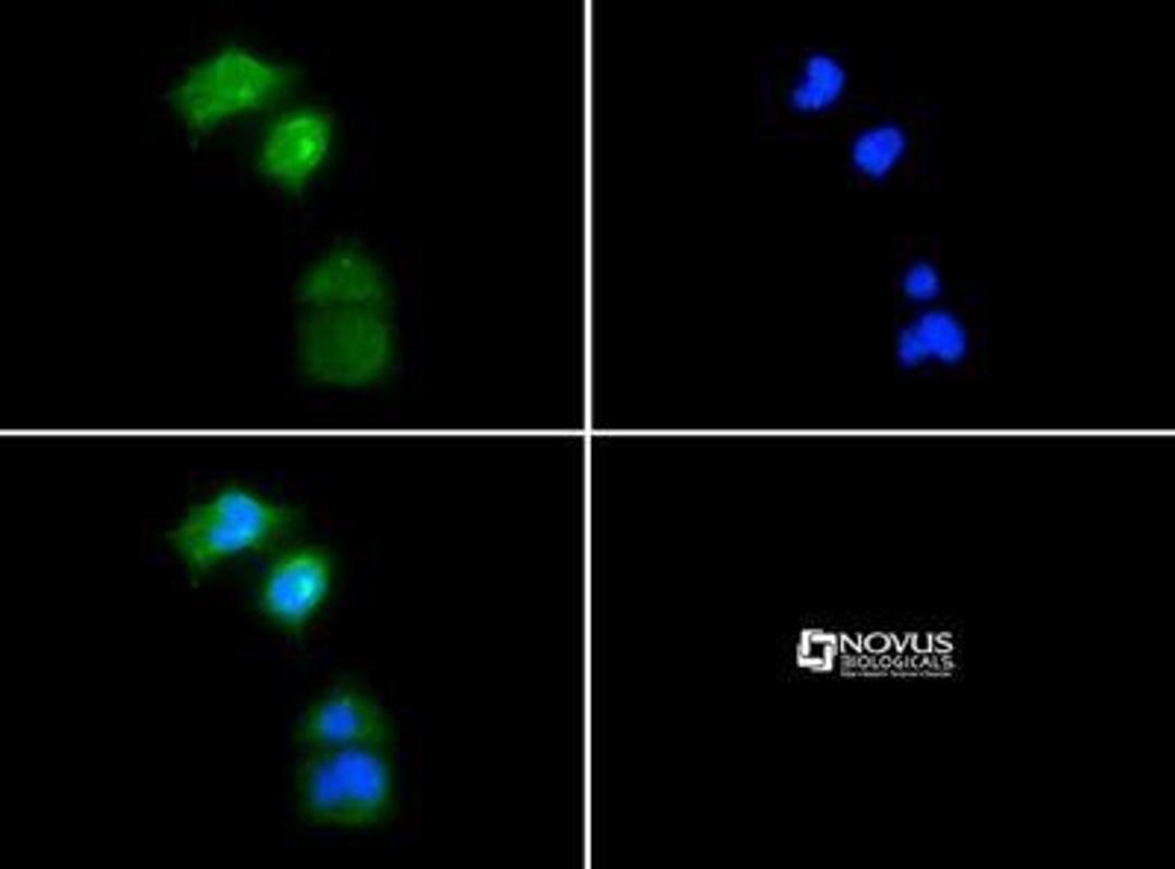 Immunocytochemistry/Immunofluorescence: PGP9.5 / UCHL-1 Antibody [NB300-675] - in Neuro2a cells with FITC (green). Nuclei were counterstained with Dapi (blue).