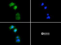 Immunocytochemistry/Immunofluorescence: PGP9.5 / UCHL-1 Antibody [NB300-675] - in Neuro2a cells with FITC (green). Nuclei were counterstained with Dapi (blue).