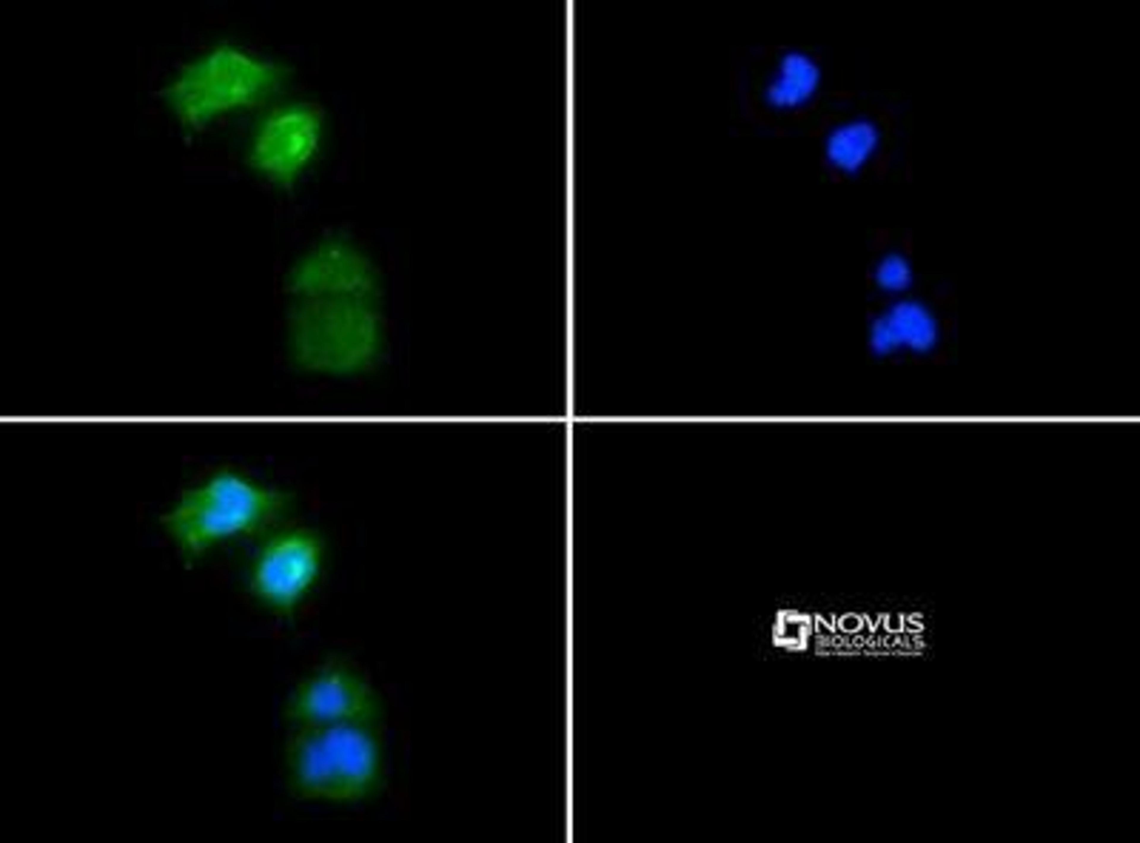 Immunocytochemistry/Immunofluorescence: PGP9.5 / UCHL-1 Antibody [NB300-675] - in Neuro2a cells with FITC (green). Nuclei were counterstained with Dapi (blue).