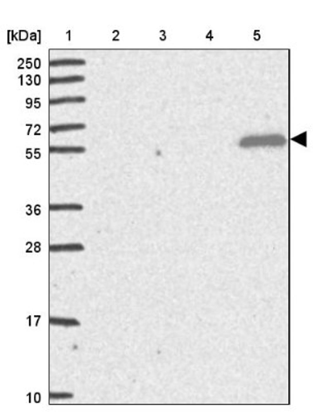 Western Blot: TRIM14 Antibody [NBP2-47596] - Lane 1: Marker [kDa] 250, 130, 95, 72, 55, 36, 28, 17, 10.  Lane 2: Human cell line RT-4.  Lane 3: Human cell line U-251MG.  Lane 4: Human plasma (IgG/HSA depleted).  Lane 5: Human liver tissue.