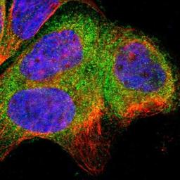 Immunocytochemistry/Immunofluorescence: SH3BP1 Antibody [NBP1-88827] - Staining of human cell line A-431 shows positivity in cytoplasm.