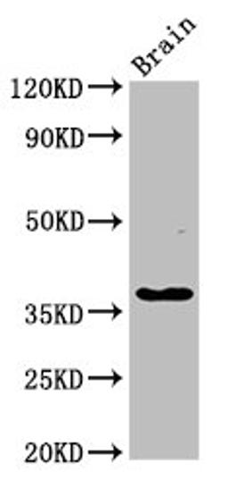 Western Blot. Positive WB detected in: Rat brain tissue. All lanes: GHITM antibody at 2.7µg/ml. Secondary. Goat polyclonal to rabbit IgG at 1/50000 dilution. Predicted band size: 38 kDa. Observed band size: 38 kDa