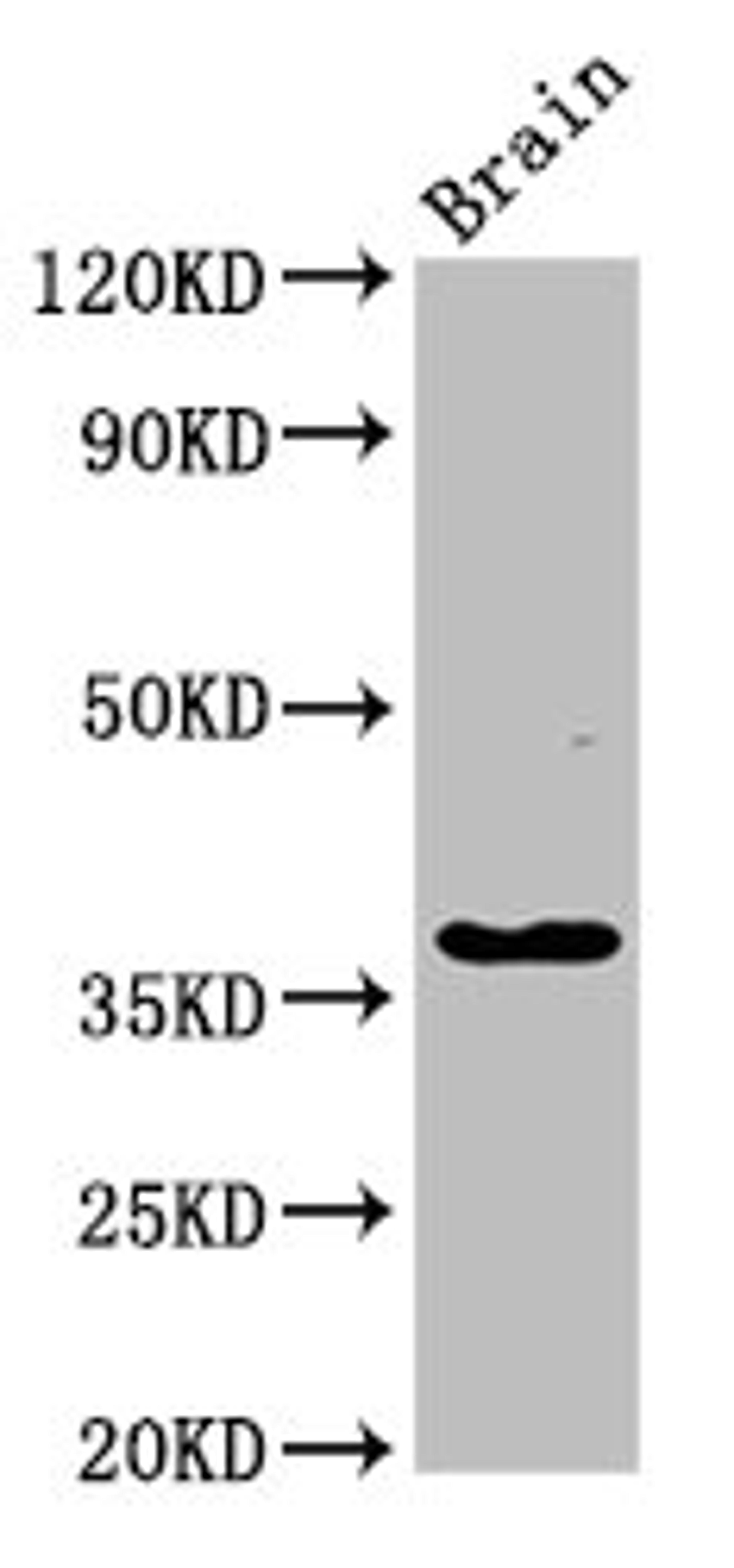 Western Blot. Positive WB detected in: Rat brain tissue. All lanes: GHITM antibody at 2.7µg/ml. Secondary. Goat polyclonal to rabbit IgG at 1/50000 dilution. Predicted band size: 38 kDa. Observed band size: 38 kDa