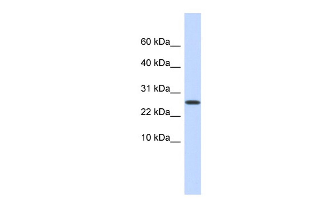 Antibody used in WB on Human Placenta at 0.2-1 ug/ml.