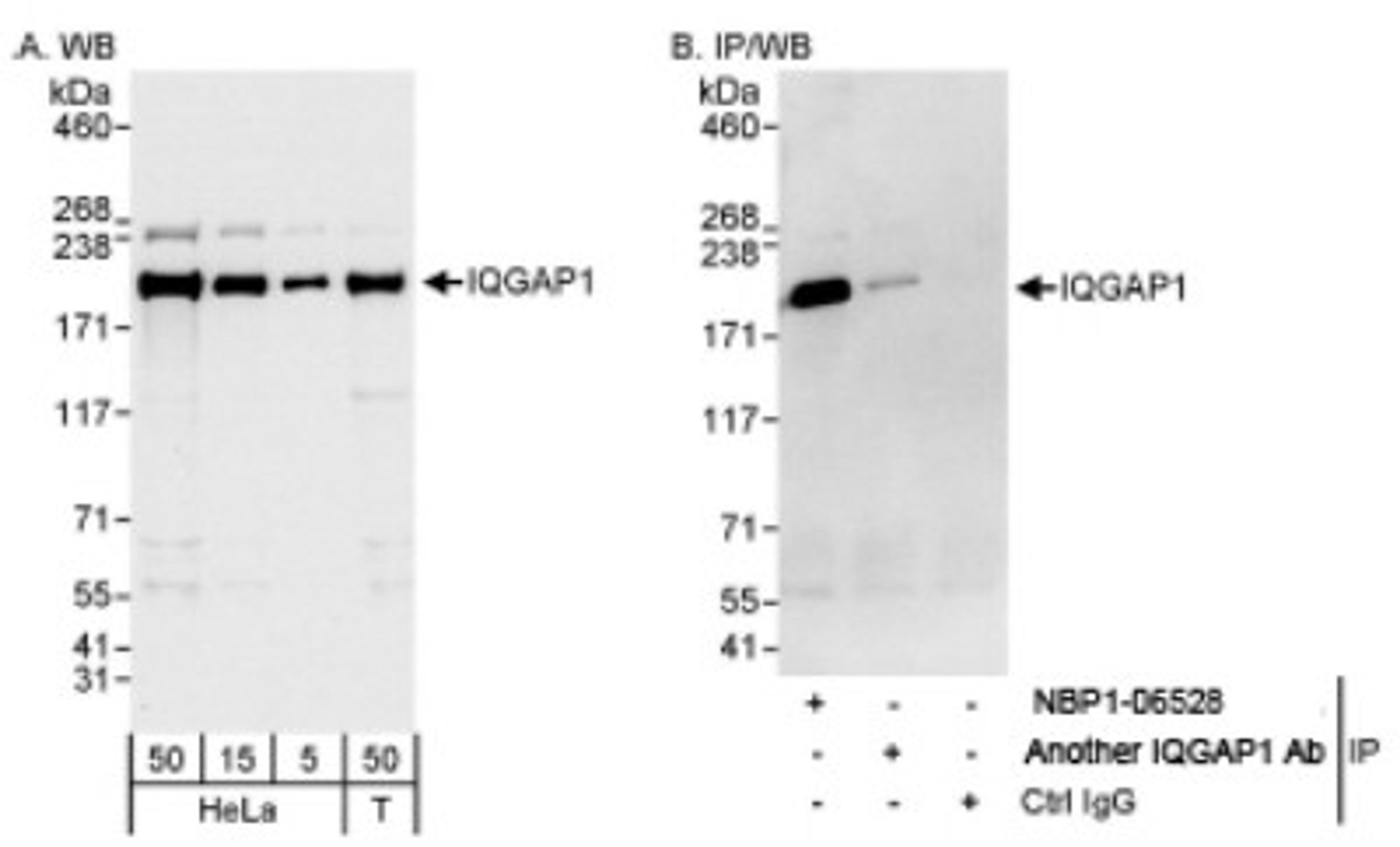 Western Blot: IQGAP1 Antibody [NBP1-06529] - Whole cell lysate from HeLa (5, 15 and 50 ug for WB; 1 mg for IP, 20% of IP loaded) and 293T (T; 50 ug) cells. NBP1- 06529 antibody used for WB at 0.04 ug/ml (A) and 0.4 ug/ml (B) and used for IP at 3 ug/mg lysate.