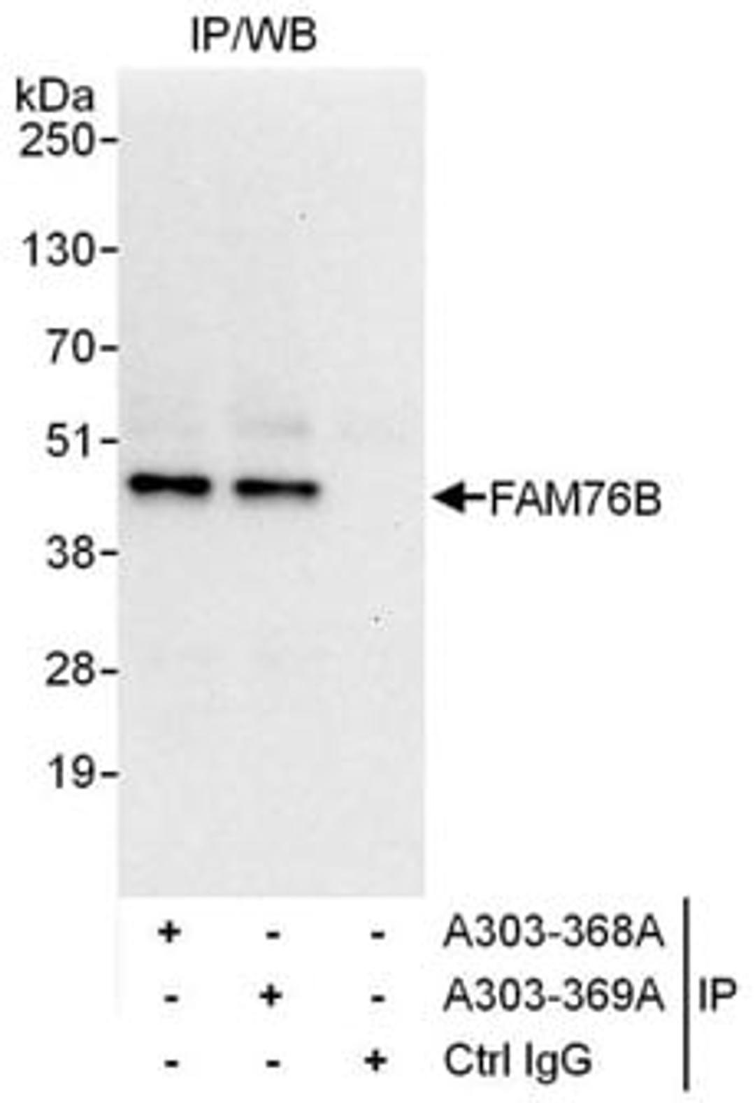 Detection of human FAM76B by western blot of immunoprecipitates.