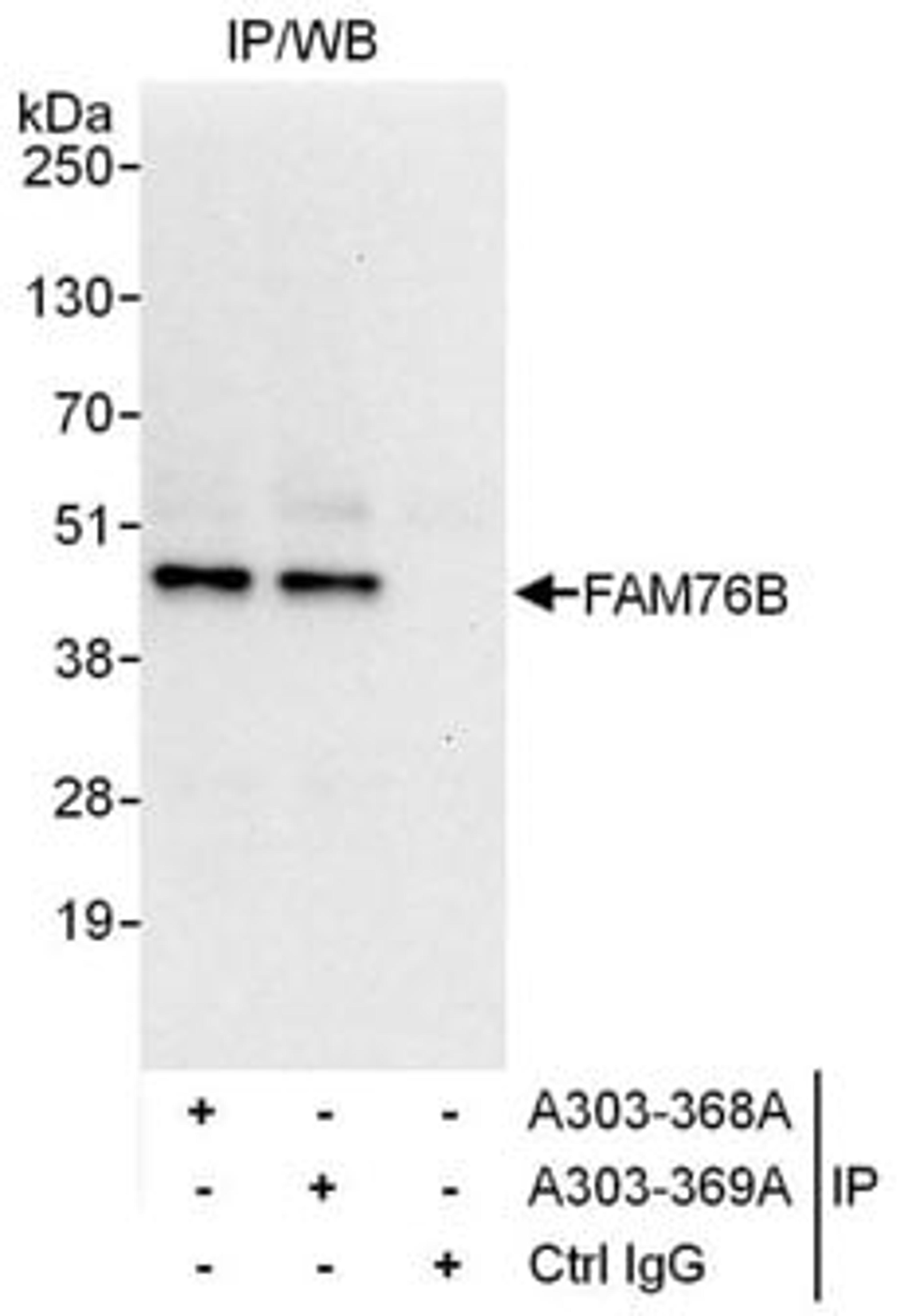 Detection of human FAM76B by western blot of immunoprecipitates.