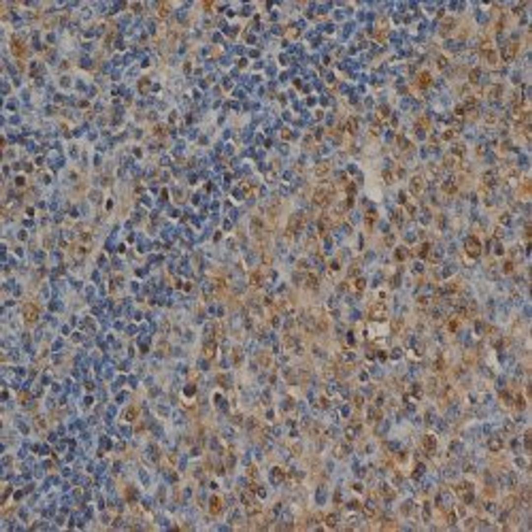 Staining of paraffin embedded human tonsil with Mouse anti Ubiquitin (MCA1398G)