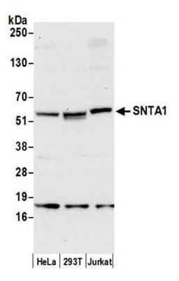 Detection of human SNTA1 by western blot.