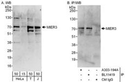 Detection of human MIER3 by western blot and immunoprecipitation.