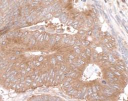 Detection of human LARP1 by immunohistochemistry.