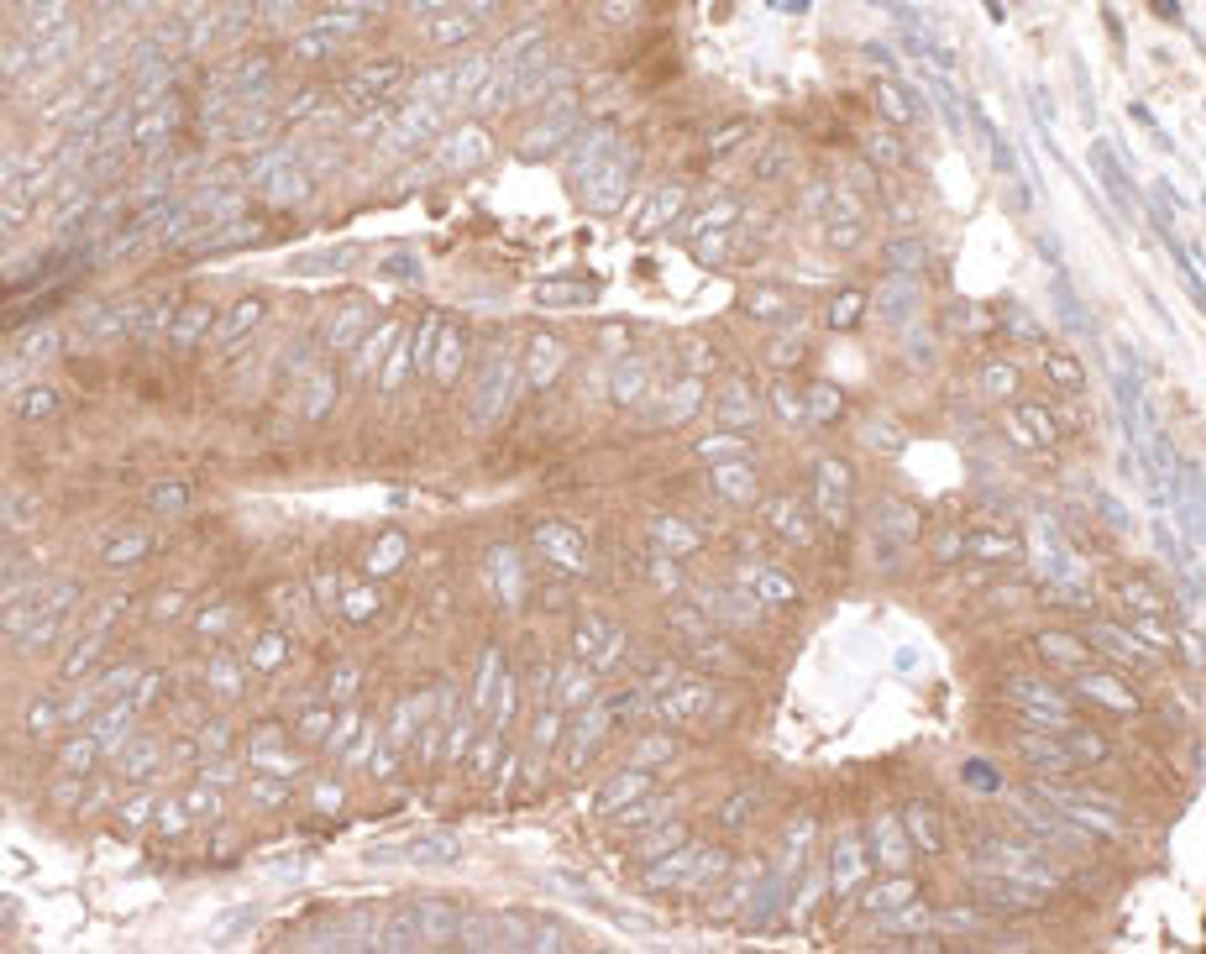 Detection of human LARP1 by immunohistochemistry.