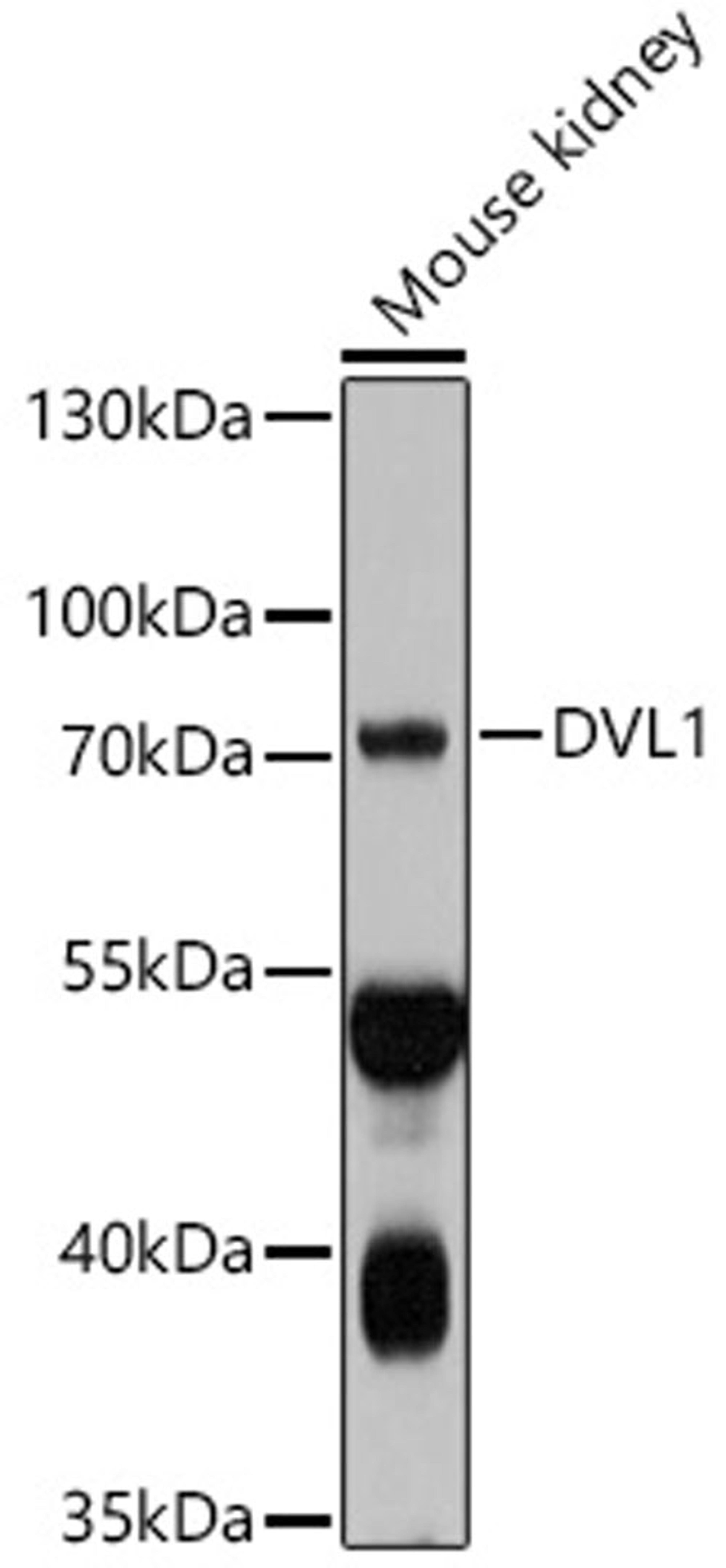 Western blot - DVL1 antibody (A10536)