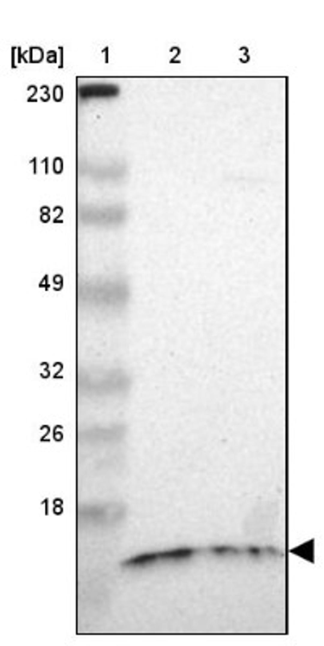 Western Blot: TIMM8A Antibody [NBP1-84288] - Lane 1: Marker [kDa] 230, 110, 82, 49, 32, 26, 18<br/>Lane 2: Human cell line RT-4<br/>Lane 3: Human cell line U-251MG sp