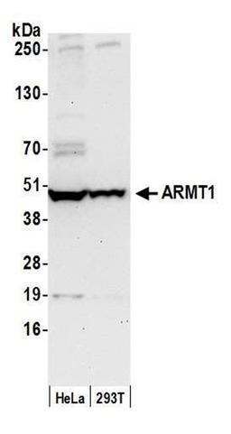 Detection of human ARMT1 by WB.