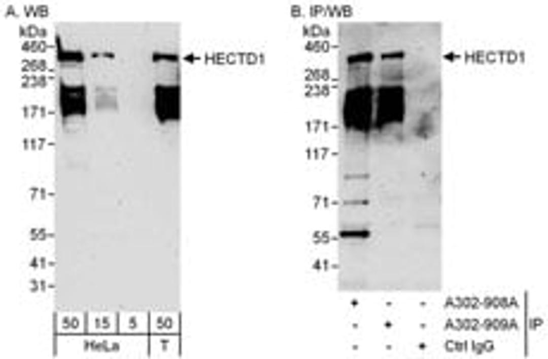 Detection of human HECTD1 by western blot and immunoprecipitation.