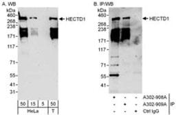 Detection of human HECTD1 by western blot and immunoprecipitation.