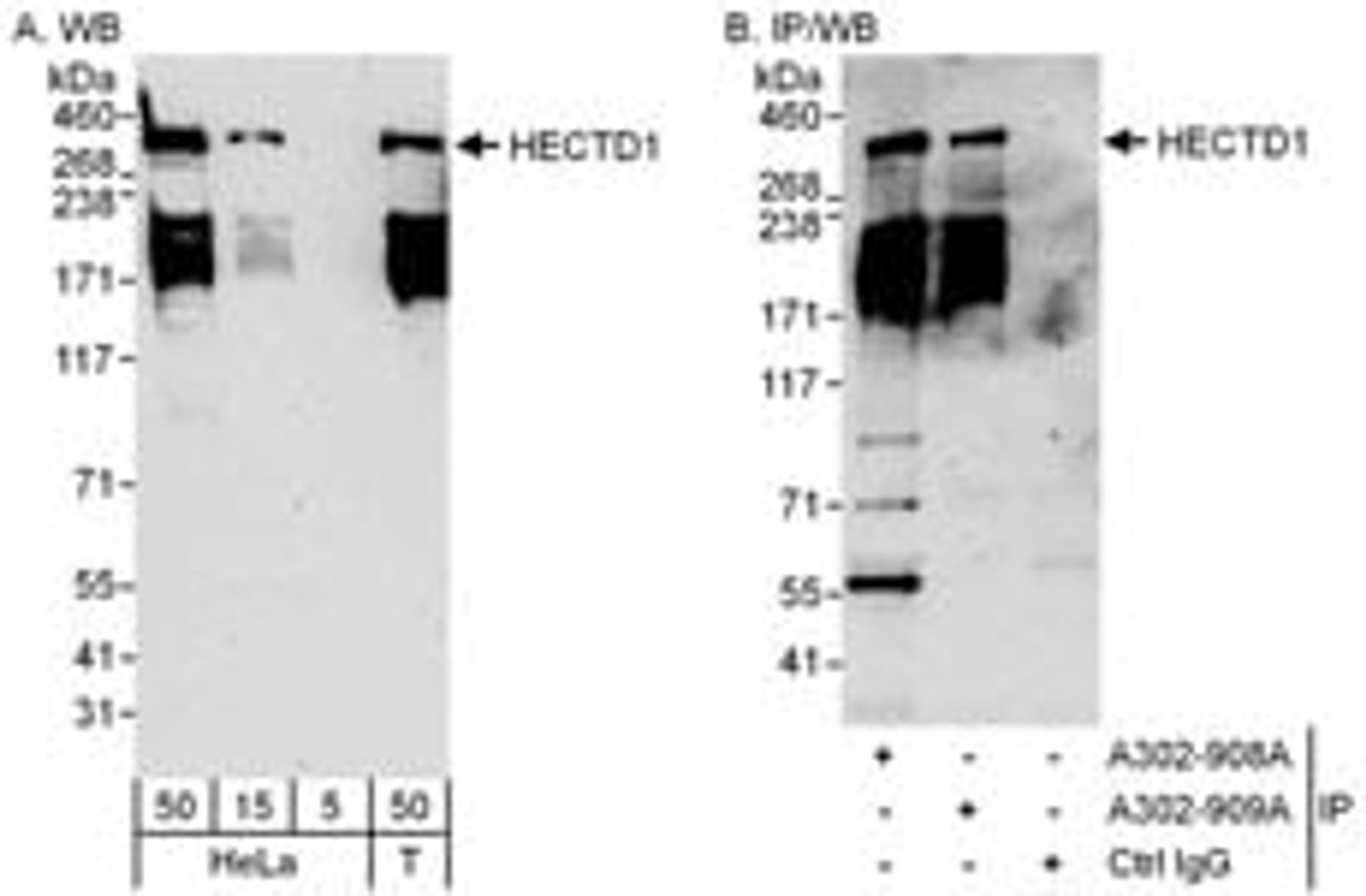 Detection of human HECTD1 by western blot and immunoprecipitation.