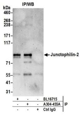 Detection of human Junctophilin-2 by western blot of immunoprecipitates.