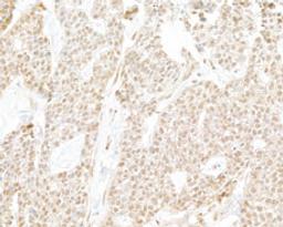 Detection of human RPB3 by immunohistochemistry.