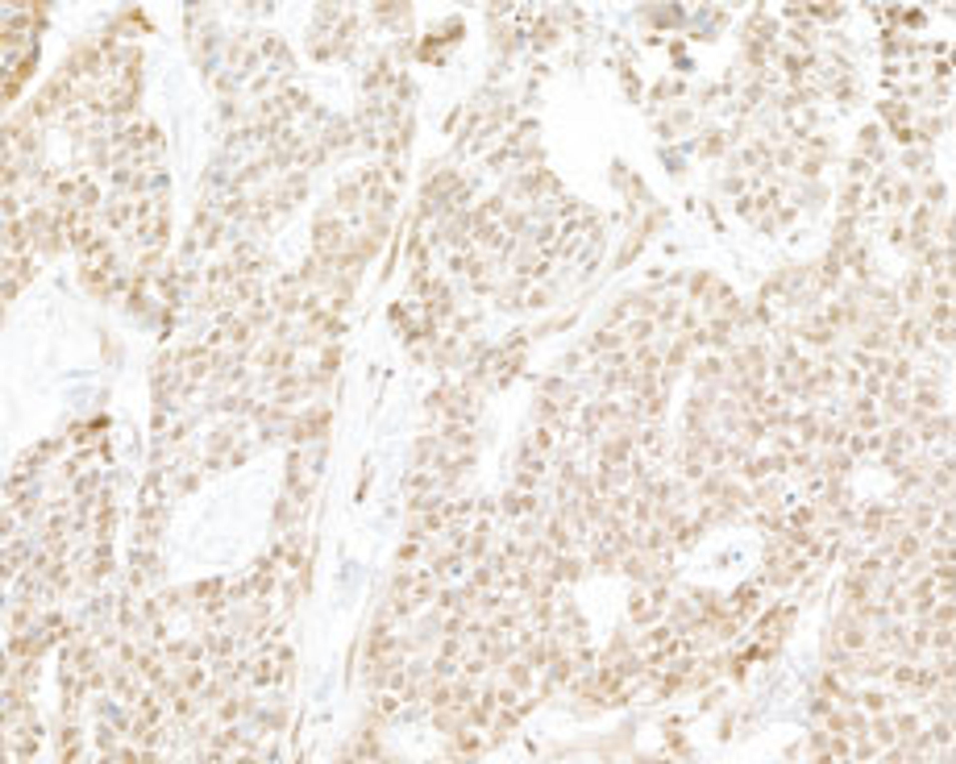 Detection of human RPB3 by immunohistochemistry.