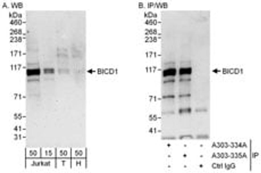 Detection of human BICD1 by western blot and immunoprecipitation.