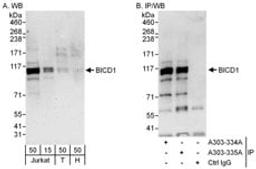 Detection of human BICD1 by western blot and immunoprecipitation.