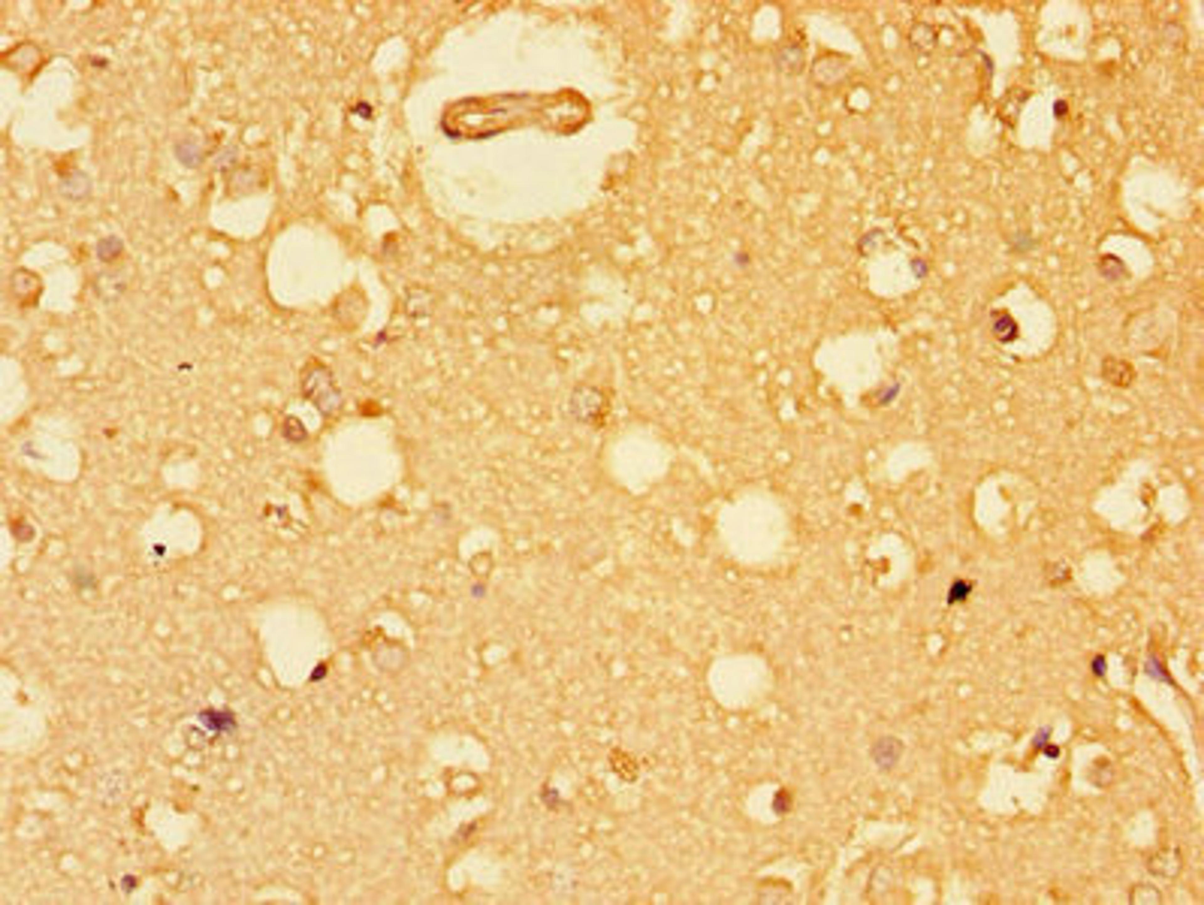 Immunohistochemistry of paraffin-embedded human brain tissue using CSB-PA007556LA01HU at dilution of 1:100