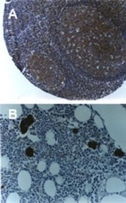 Immunohistochemistry-Paraffin: TRAF4 Antibody [NB100-56177] - Formalin-fixed, paraffin- embedded tissue sections stained for TRAF6 using NB100-179 at 1:2000. Hematoxylin-eosin counterstain. A, mouse lymph node. B, mouse bone marrow.