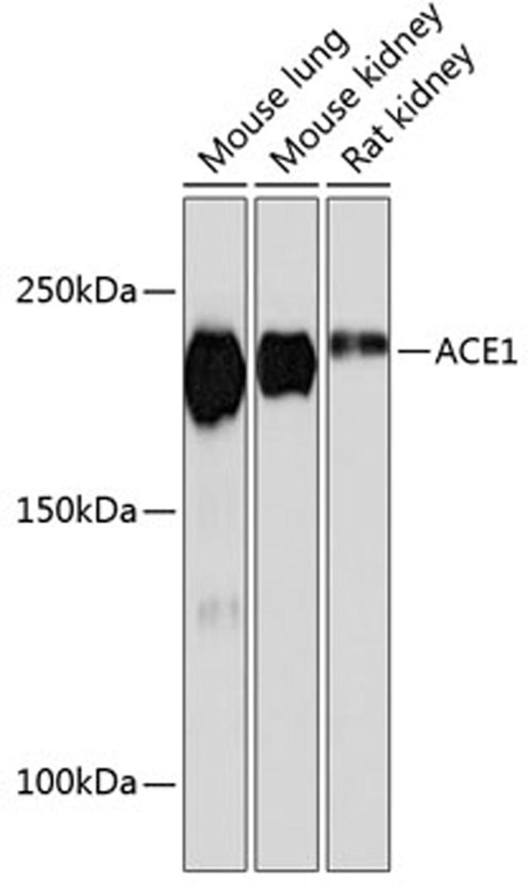 Western blot - ACE1 Rabbit mAb (A11357)