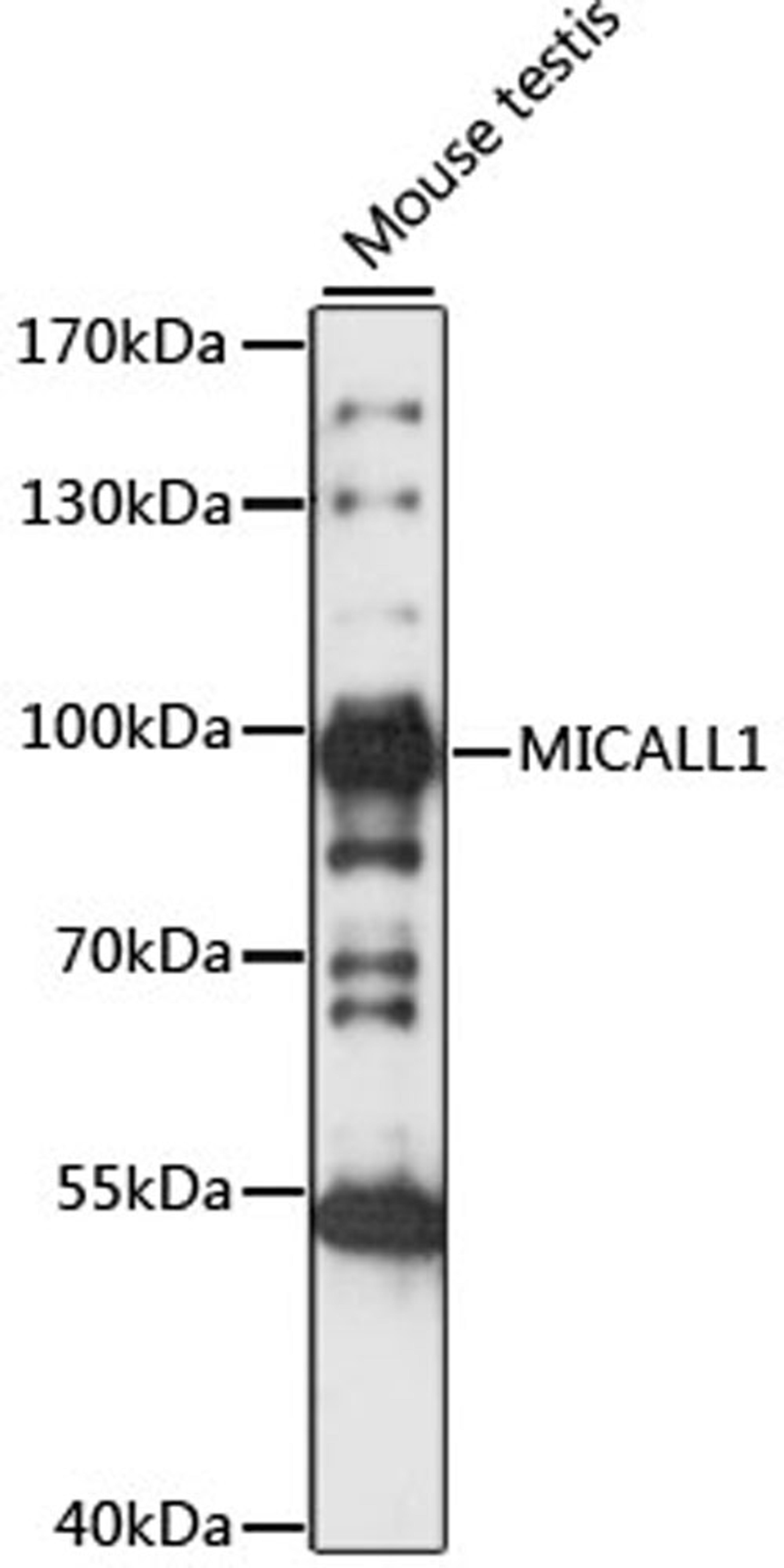 Western blot - MICALL1 antibody (A15541)