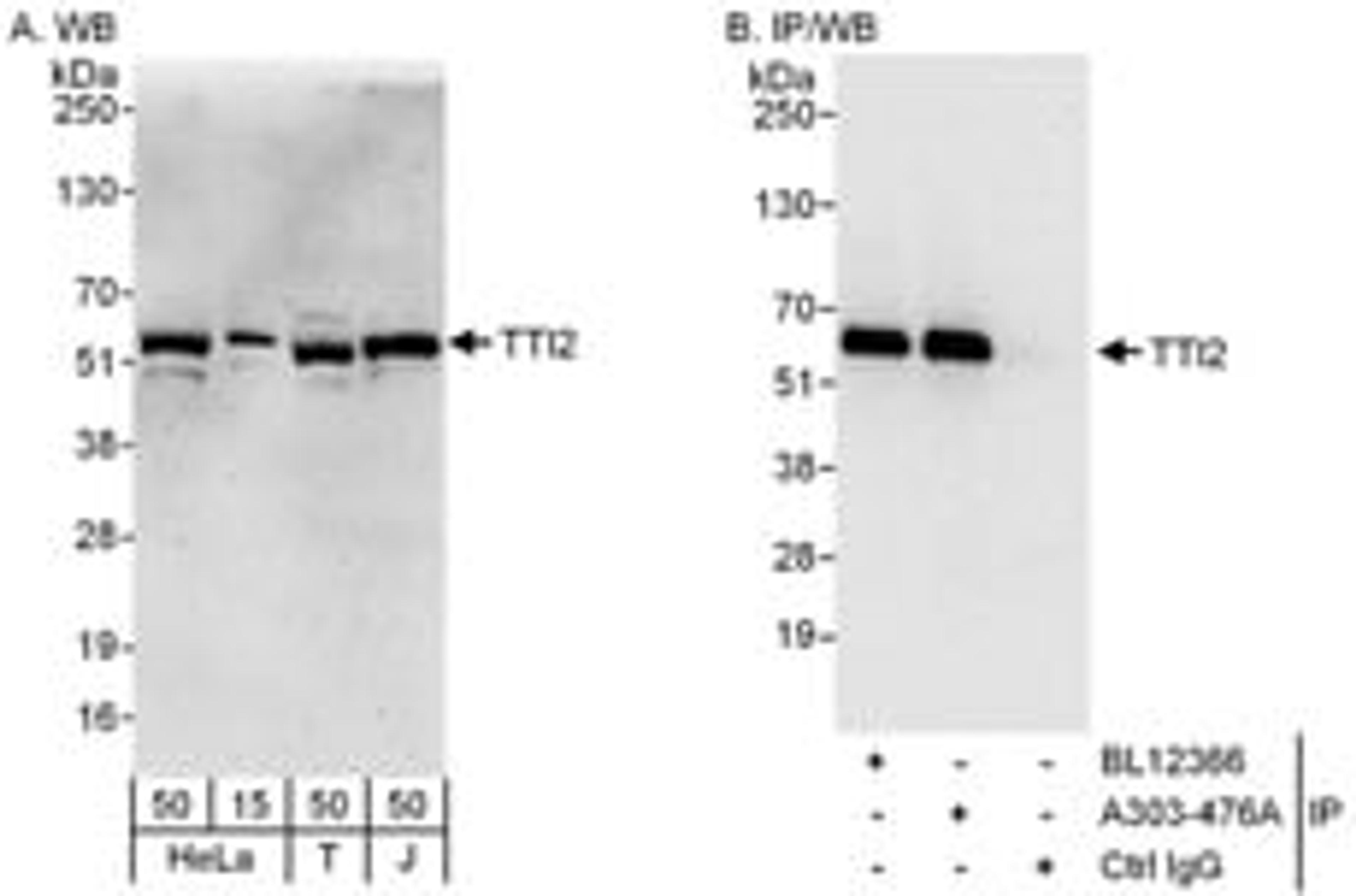 Detection of human TTI2 by western blot and immunoprecipitation.